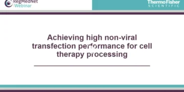 Achieving high non-viral transfection performance for cell therapy processing