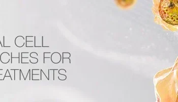 Scaling Non-Viral Cell Therapy Approaches for Solid Tumor Treatments